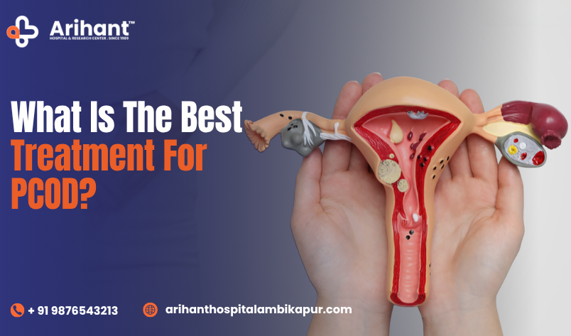 What is the Best Treatment for PCOD?